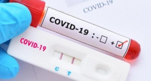 Новите случаи с коронавирус у нас са 1862 положителни са